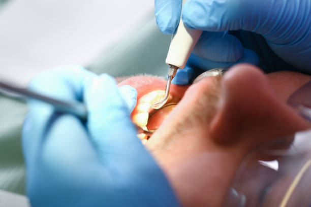 Best Cosmetic Emergency Dentistry in Vernon, AL