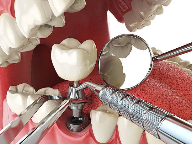 Best After-Hours Dental Trauma Care in Vernon, AL